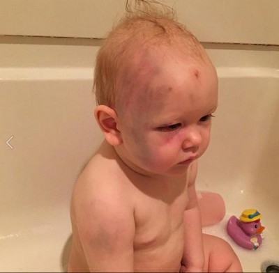 Un Bebe Violemment Battu Pas Sa Baby Sitter Cette Derniere Echappe A La Justice Un Bebe Violemment Battu Pas Sa Baby Sitter Cette Derniere Echappe A La Justice