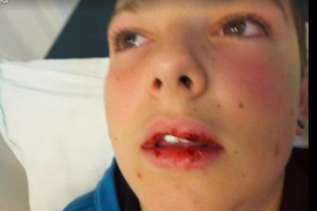 Un Garcon De 13 Ans Passe A Tabac Pour Son Velo
